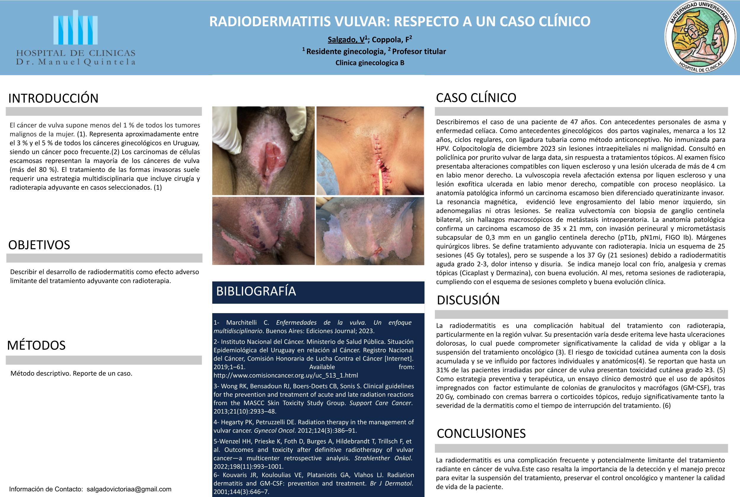 RADIODERMATITIS VULVAR: RESPECTO A UN CASO CLÍNICO
